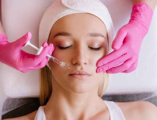 What to Know Before Getting Fillers