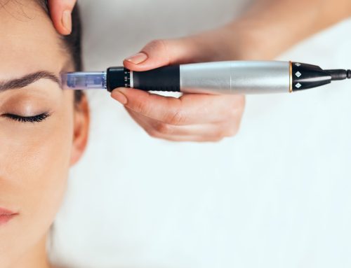 What is Microneedling and How Does it Benefit Your Skin?