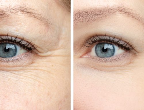 Exploring the Latest Breakthroughs in Anti-Aging Eye Treatments