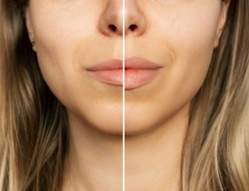The Benefits of Lip Enhancement Procedures