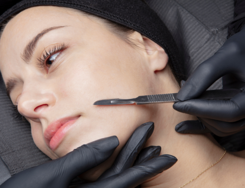 Give Your Face A Natural Glow Up With Dermaplaning